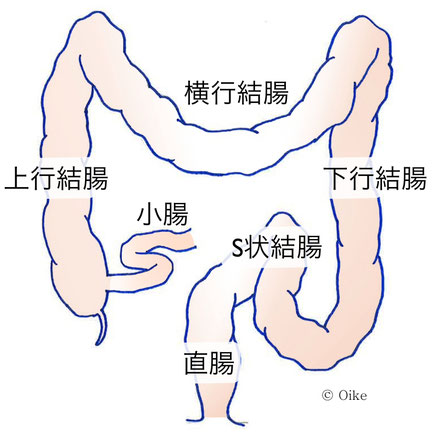 大腸癌について02