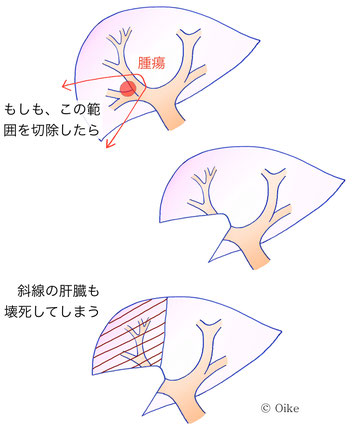 肝臓02