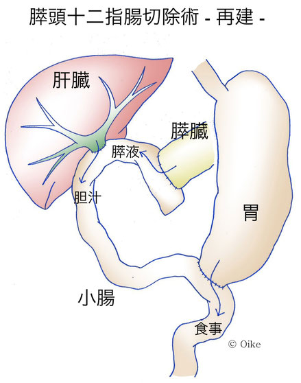 膵癌について03