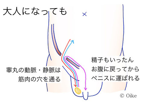 そけいヘルニアについて2