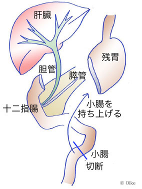 ルーワイ法